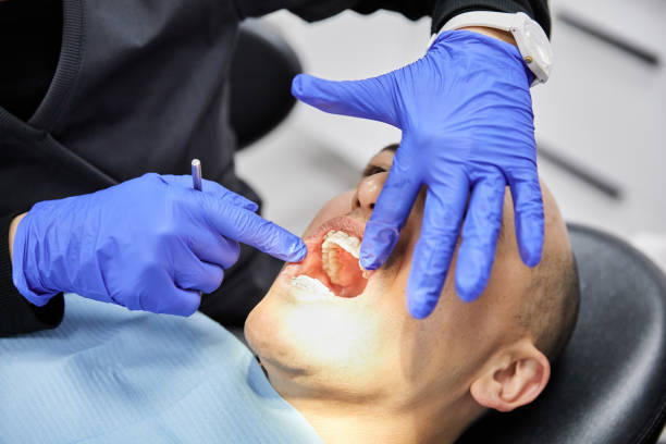 Best Broken Tooth Emergency  in Adelino, NM