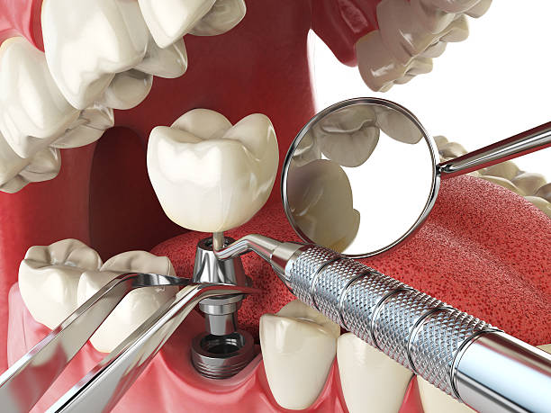 Best Knocked-Out Tooth Emergency  in Adelino, NM